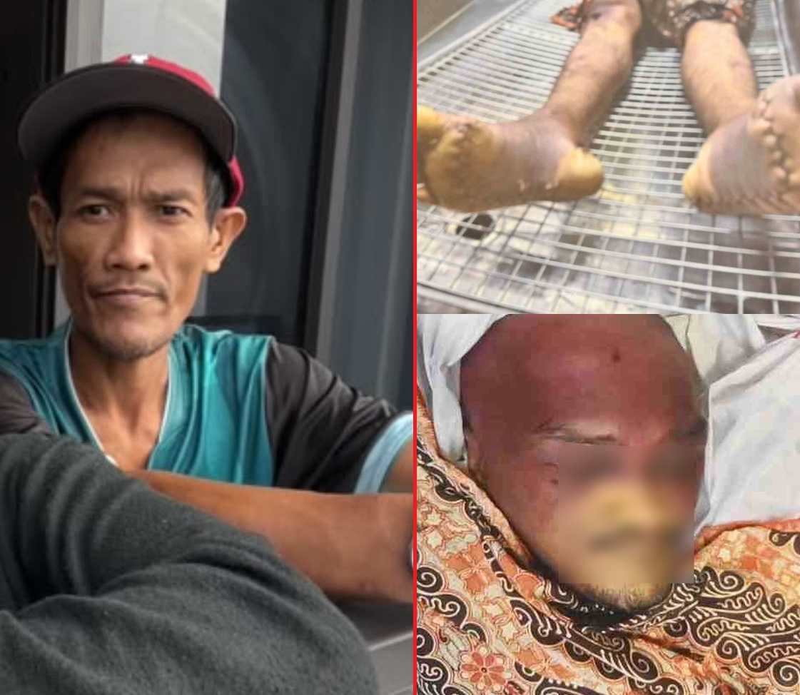 ‘Grisly pictures’ and 18-hour delay to inform family: Lawyers demand murder probe after shocking death in police custody